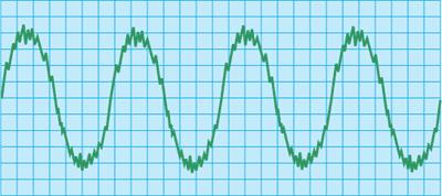 Glossary of Power Quality Problems